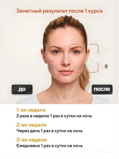 Третиноин гель 0.1 %  A-Ret Gel 0.1 %