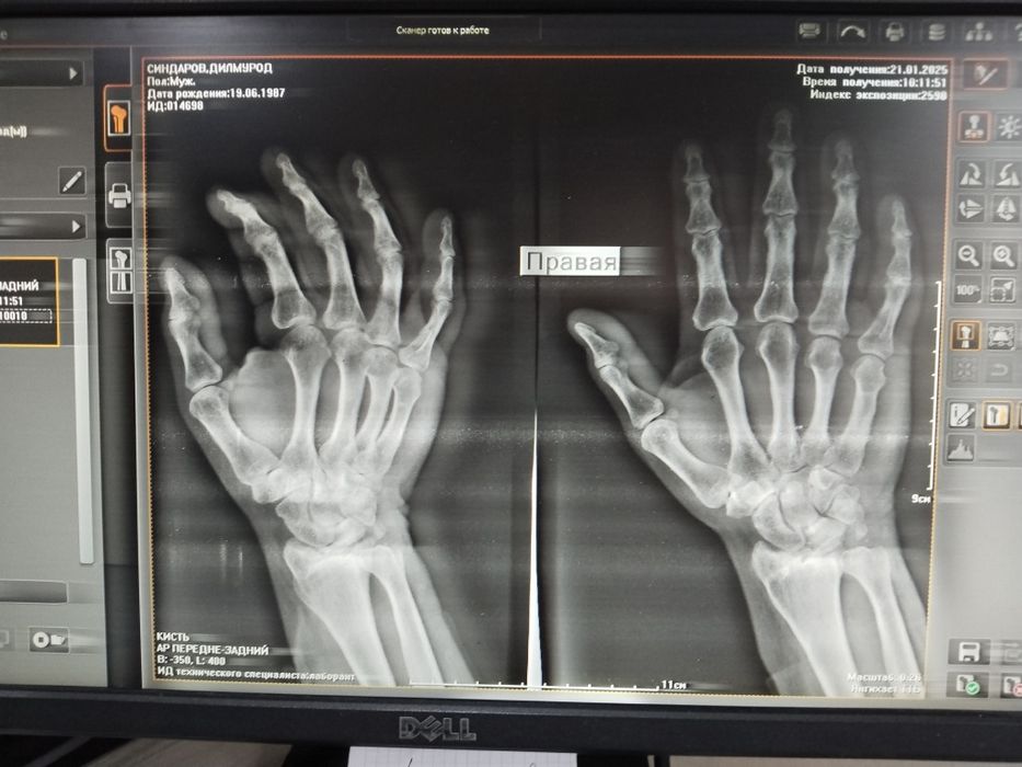 Газосварка электросварка