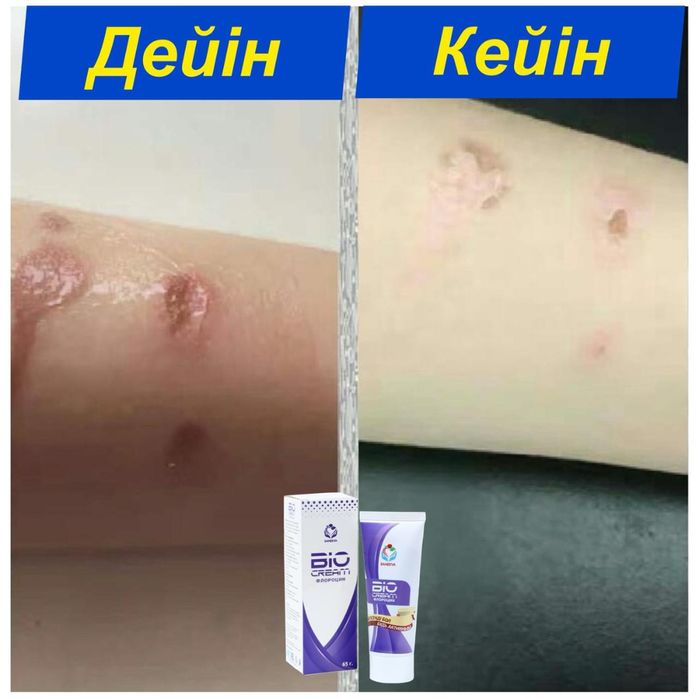 Био крем bio cream, флорацин чудо крем