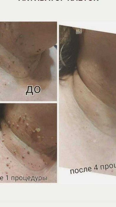 Иновативен уред за оздравителни сеанси THZ Health