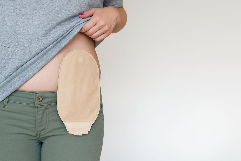 Уход за стомой в Ташкенте консультация от хирурга