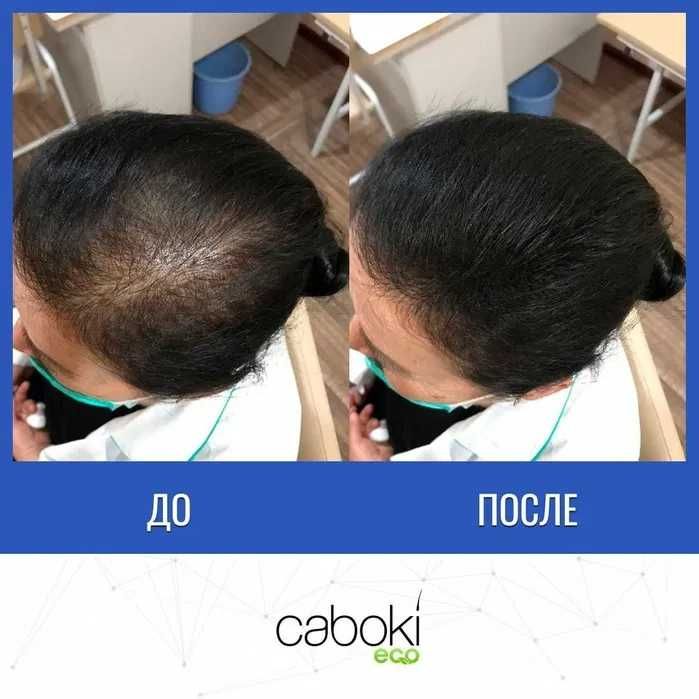 Сочни қалинлаштирувчи Caboki 25 g. | Доставка бепул