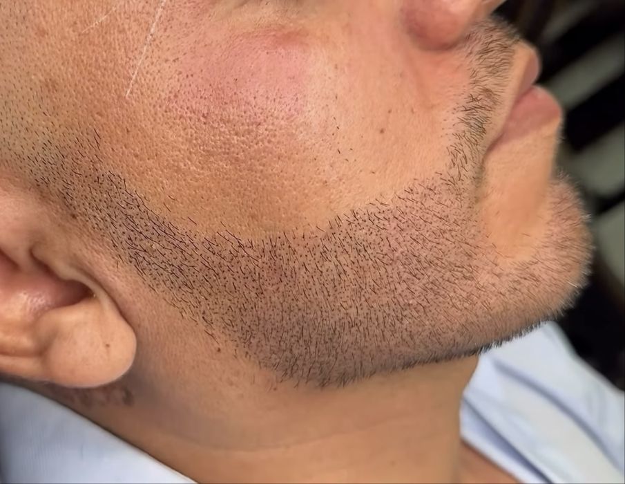 Micropigmentare barba scalp sprancene barbati Bucuresti