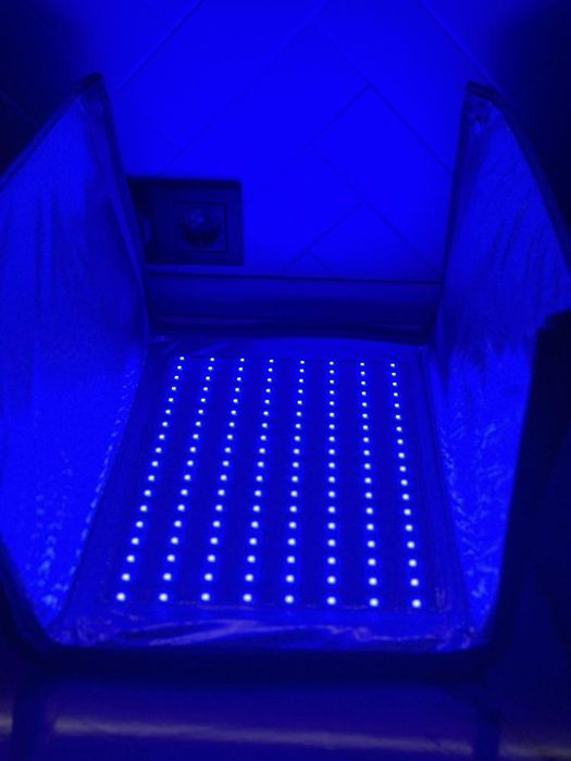 Фототератия, фотолампа от желтушки новорожденных, повышенный билирубин