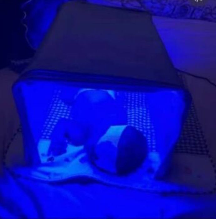 Лампа от желтушка