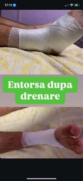 Masaj/kinetoterapie/chiropractica/recuperare la domiciliu