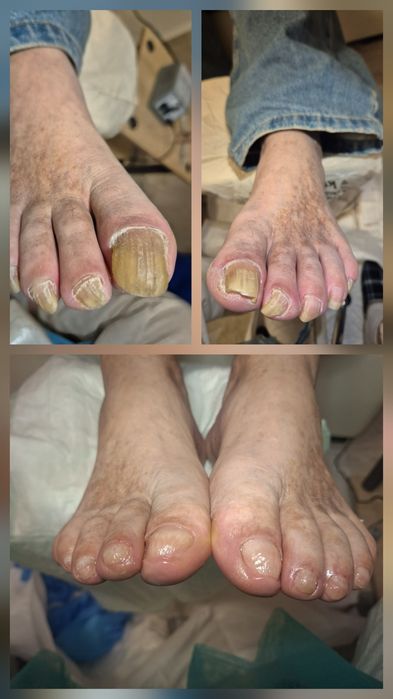 Pedichiura curativa