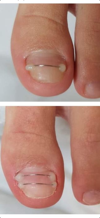 Мужской педикюр маникюр