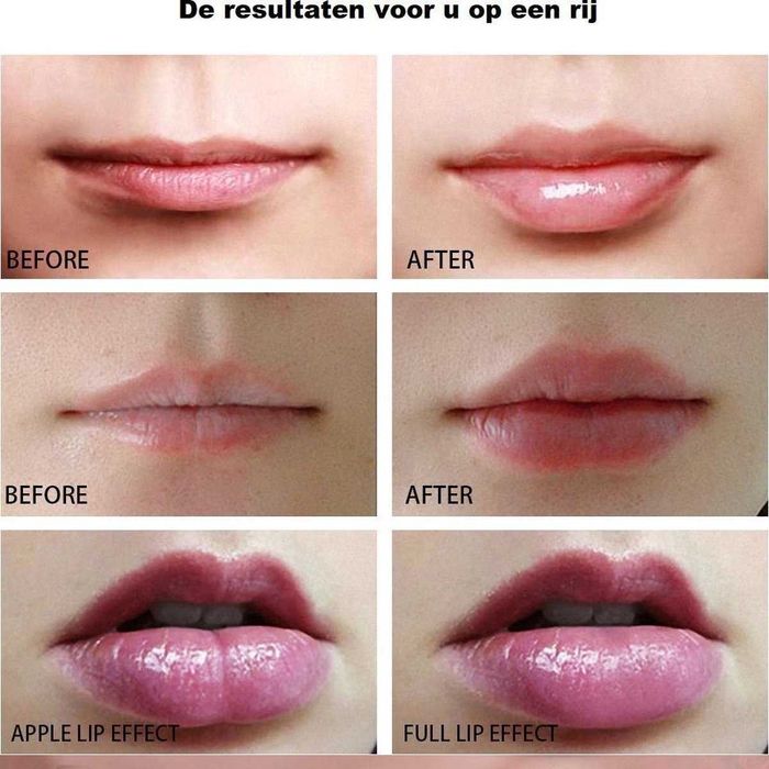 Силиконово устройство за уголемяване на устни, Мигновен ефект