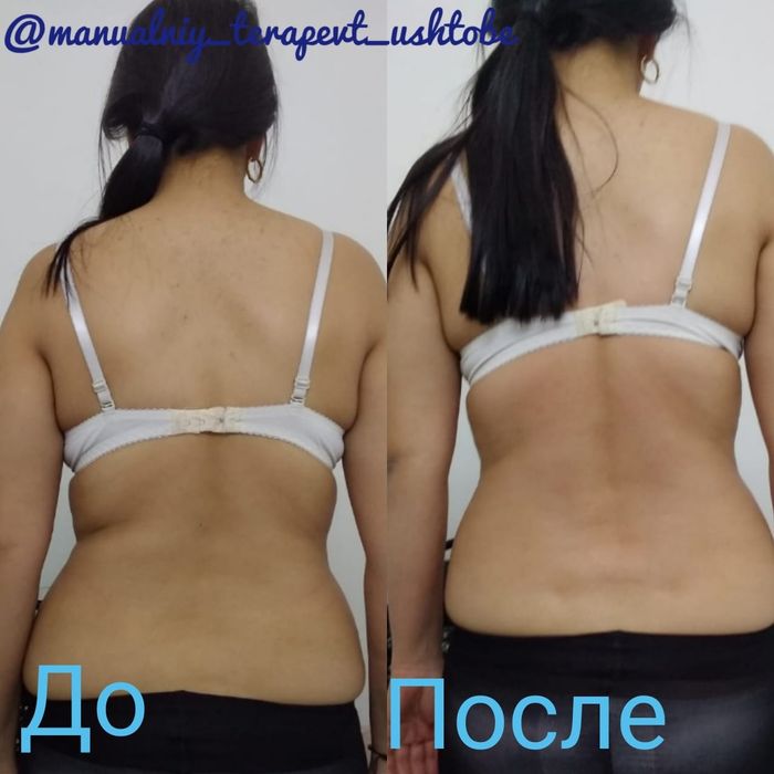 Хиджама/Массаж на выезд