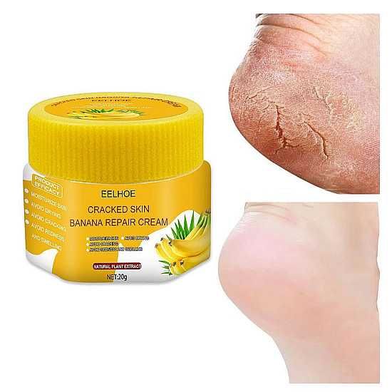 Възстановяващ крем за крака и ръце, Предотвратява сухата напукана кожа