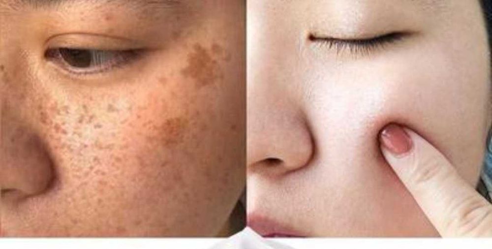 Отбеливающее мыло оригинал