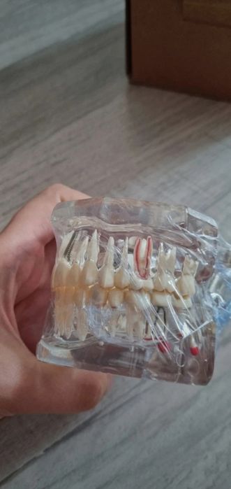 Model dentar multiple patologii