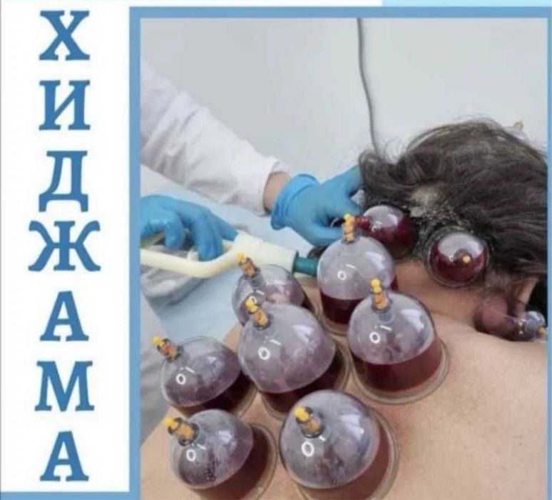 Хиджама Астана | Пиявки | Шертпе