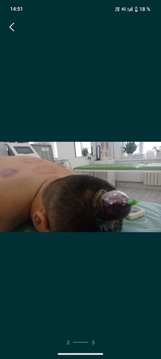 Хиджама , Массаж