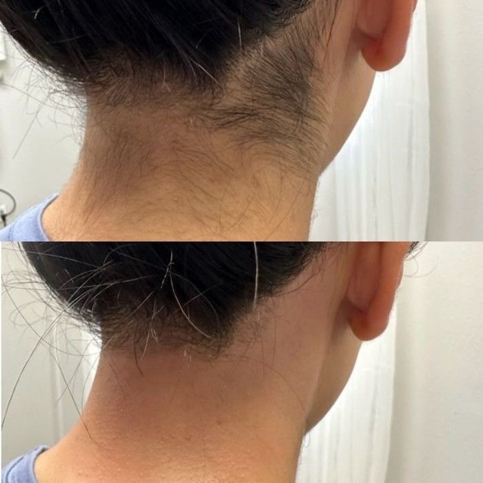 Услуги шугаринга с выездом