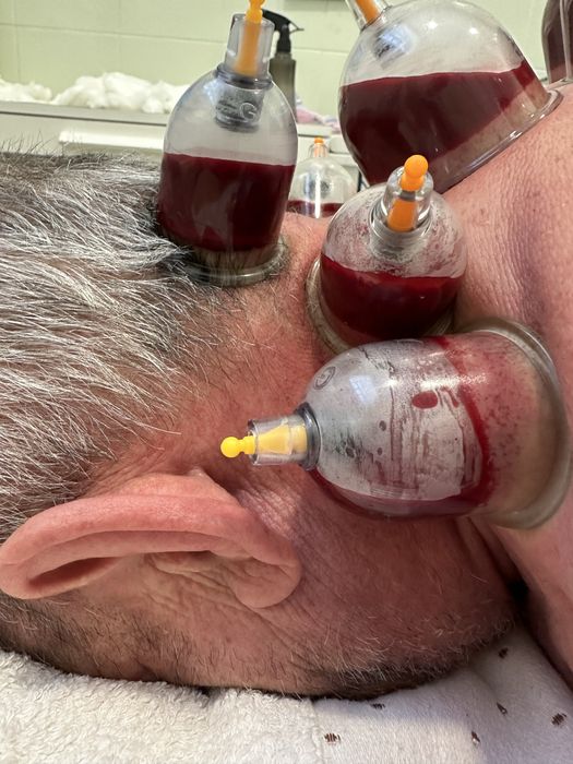 Хиджама в районе 45 квартала