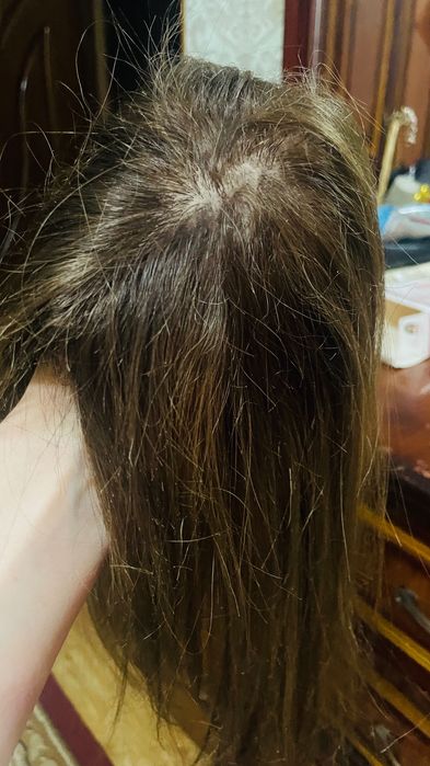 Макушка табиий соч ва зажимли улама соч (Алохида хам сотилади)