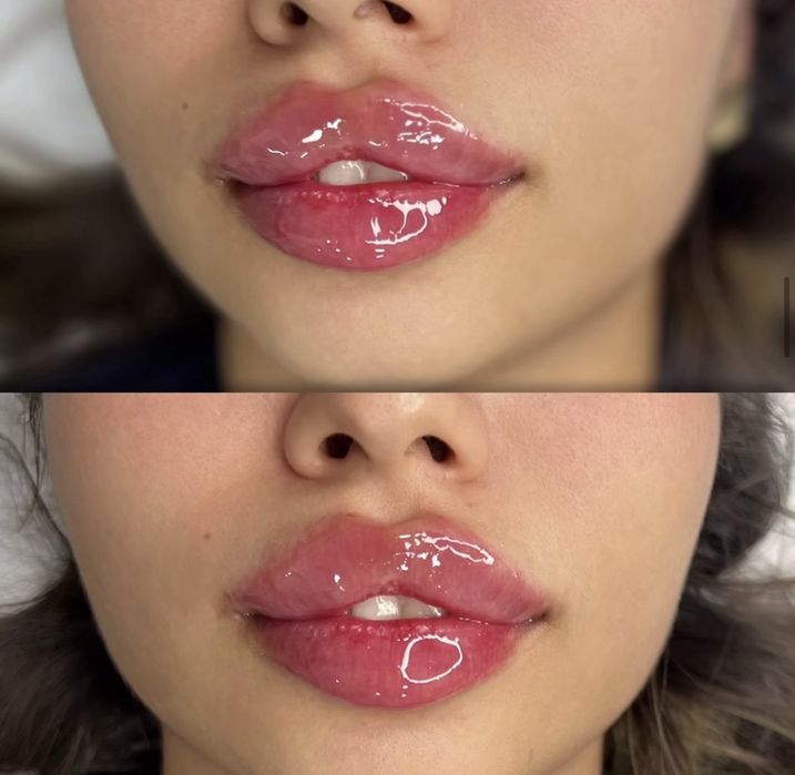 Kosmetolog +Bio Texnika Rastushovka