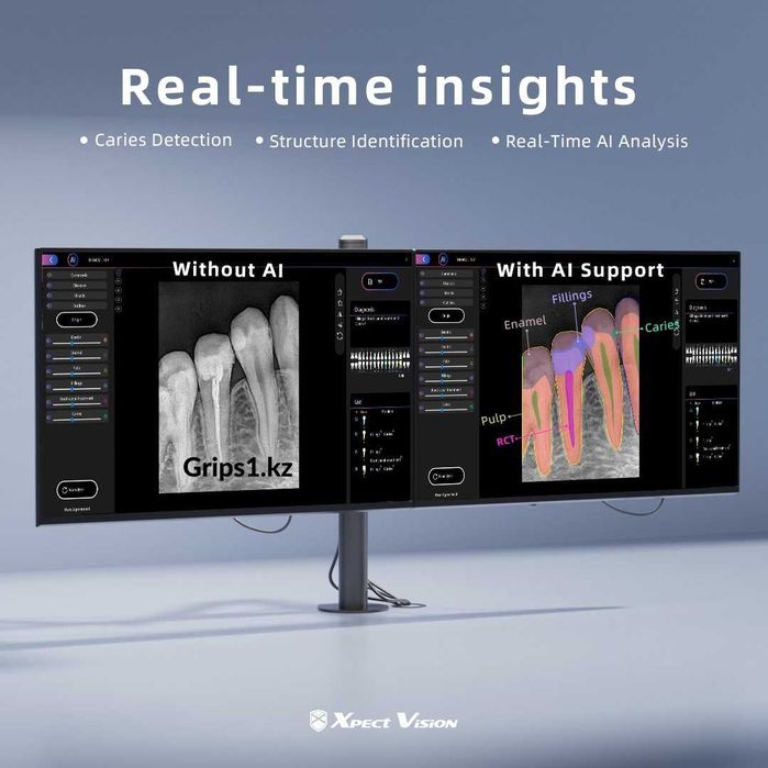 Визиограф PhoCo Mini - сенсор с AI модулем. Радиовизиограф