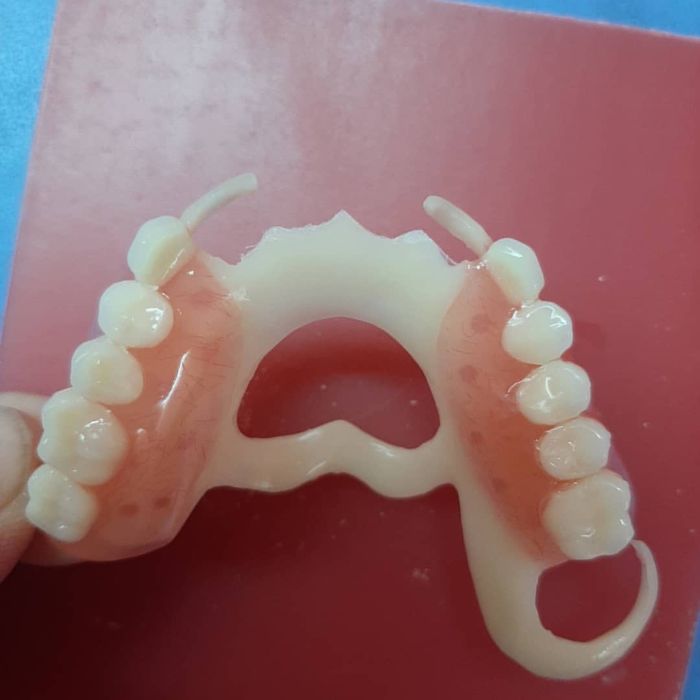 Протез зубной тех