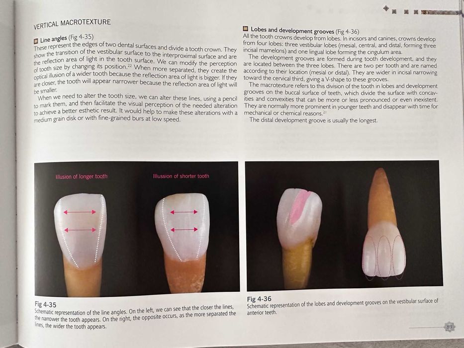 Carte stomatologie „Veneers: Fantasy, Risk, Success”