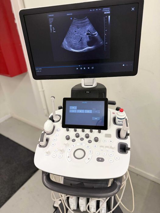 Samsung HS60 экспертный УЗИ аппарат