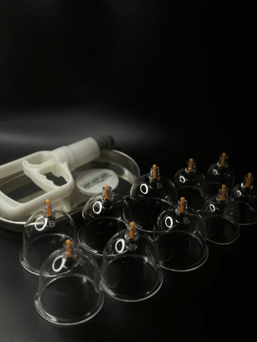 Хиджама лечебная