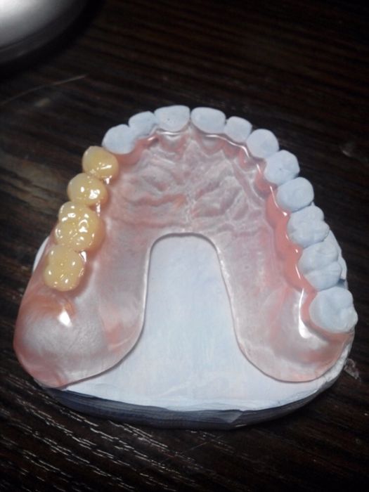 Сьемные протезы!