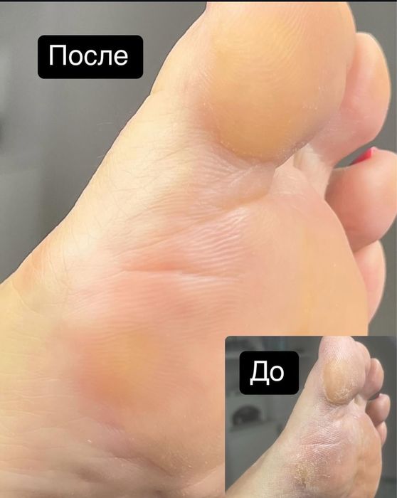 Подолог, Маникюр, Педикюр