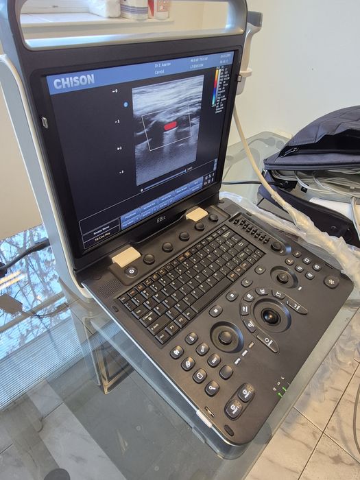 Ехограф Chison EBit 60 (2018) + Линейна сонда –