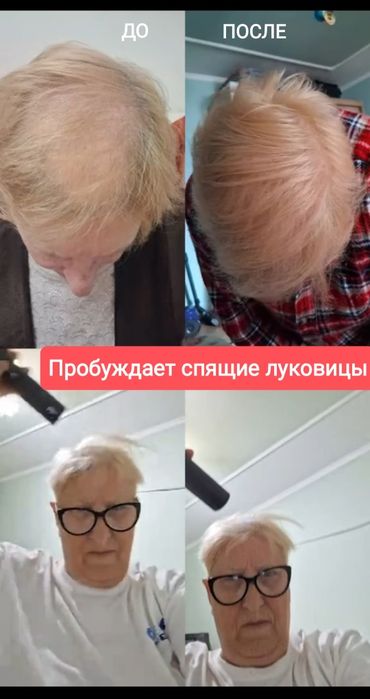 Прибор активирует клетки. Оригинал