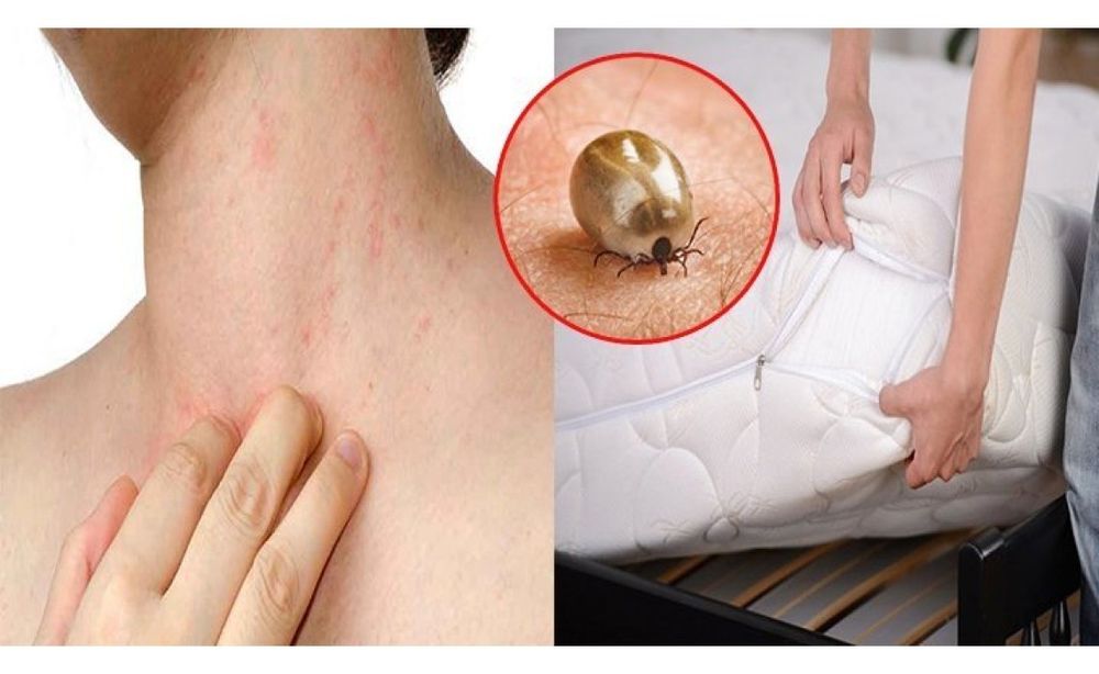 produs fara acarieni spray saltele husa pat canapea tratament  somn