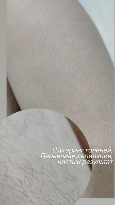 Депиляция для девушек! Шугаринг, полимерный воск! Более 3 лет стажа