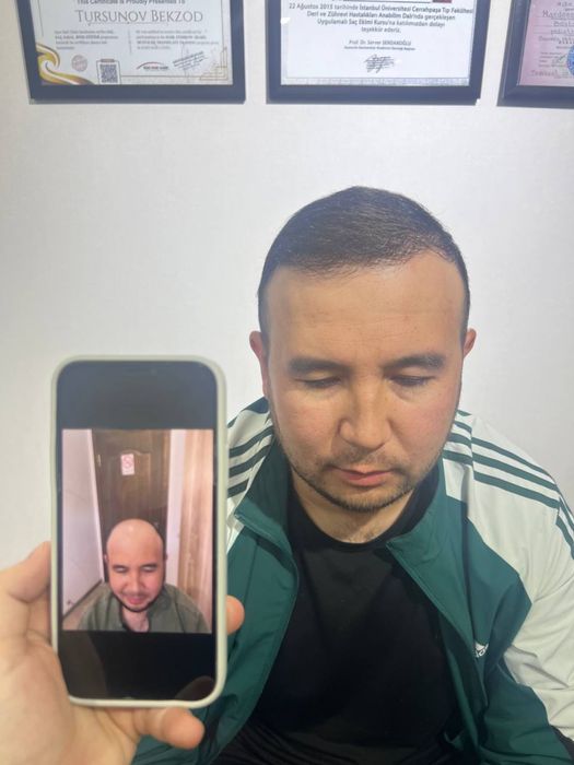 Soch Ekamiz 100% Garantiya