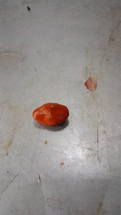 Сиырдын өт тастар