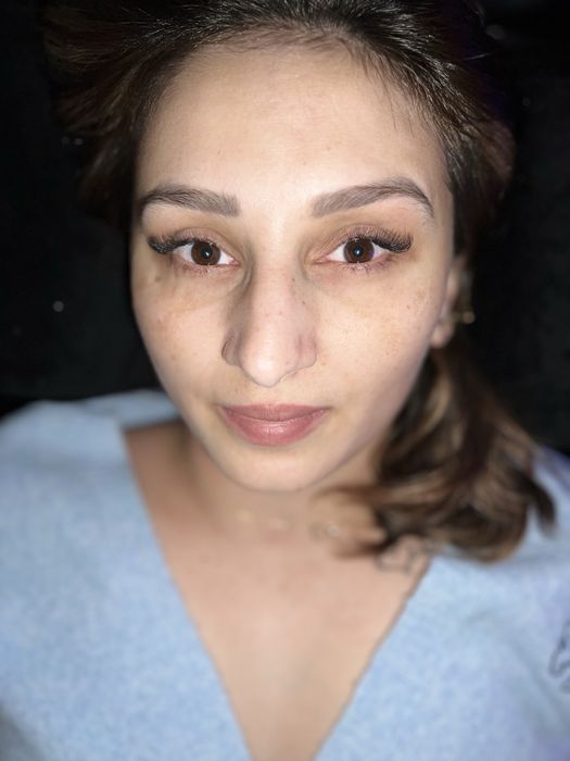 Extensii gene Timisoara