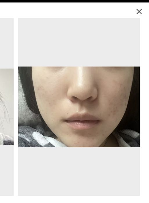 Medecassos Blemish Repair Serum — полный, без коробки