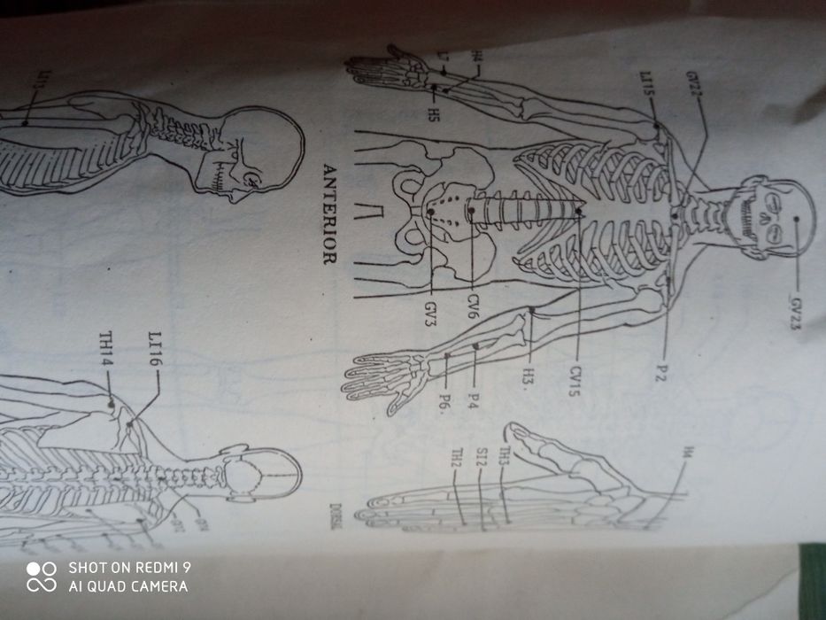 Нейростимулатор Энс