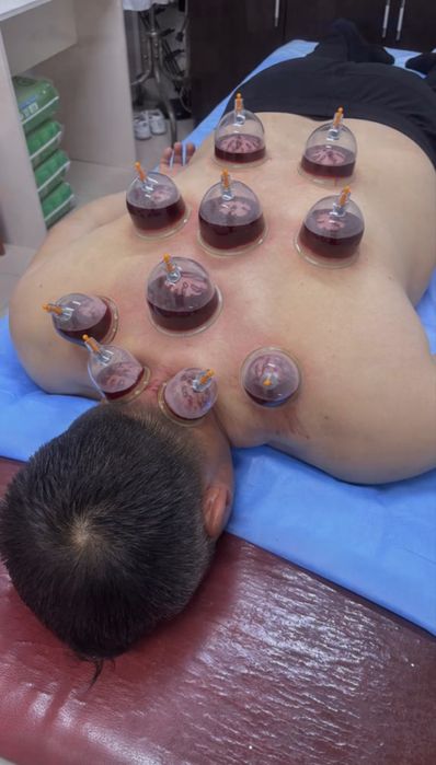 Хиджама, Пиявки Массаж емдері