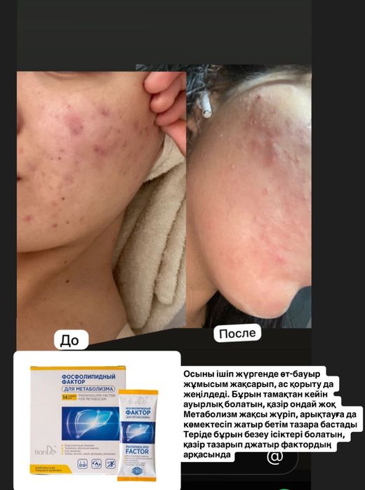 Фосфолипидный фактор