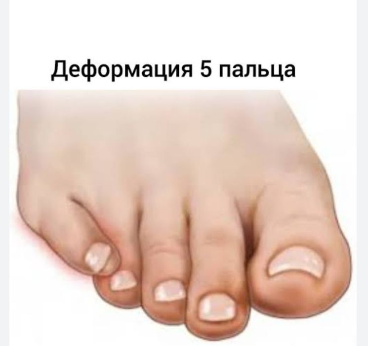 Квалифицированная помощь подолога.