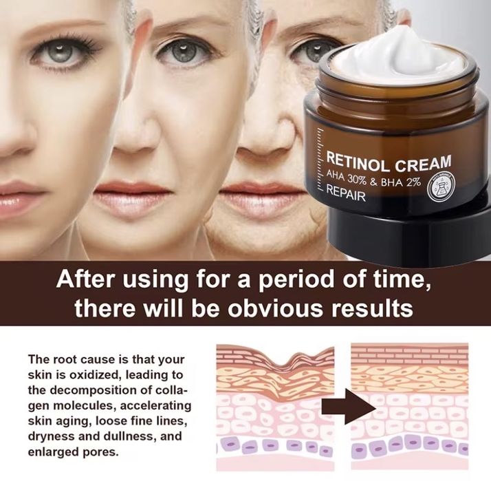 Крем за бръчки за жени