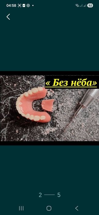 Микропратез тез кунде