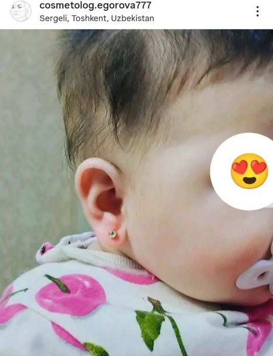 Прокалывание ушей