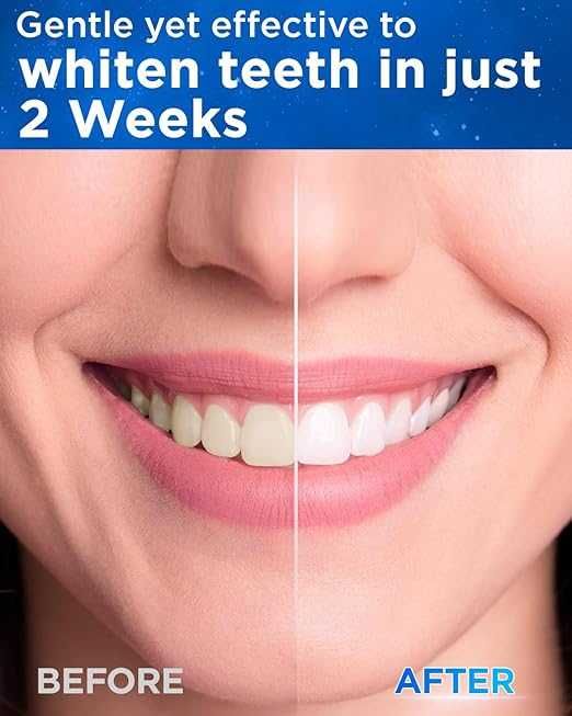 Електрическа звукова четка за зъби Yteath Y08 с 8 глави USB C Розова