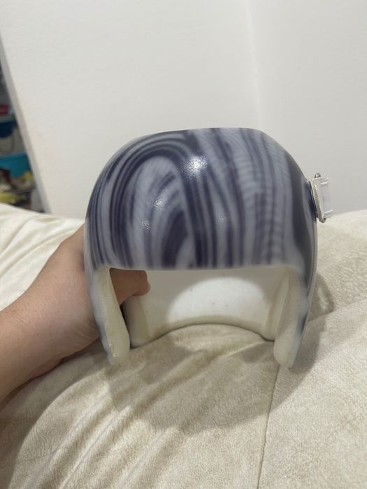 Ортопедический шлем детский