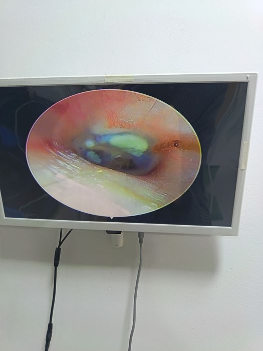 Видеоэндоскопия Продам Срочно