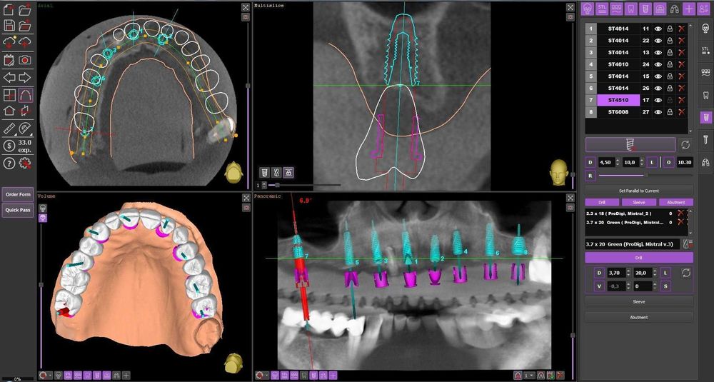 Realguide 5.4.2 + ImplantStation 5.3.2 + BlueSkyPlan + ImplantStudio