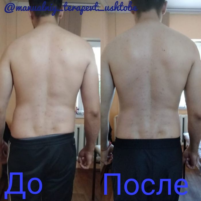Хиджама/Массаж на выезд